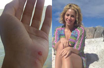 Shakira sufre el ataque de un león marino